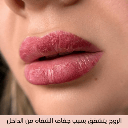 ديرول لروج ناعم بدون تقشرات